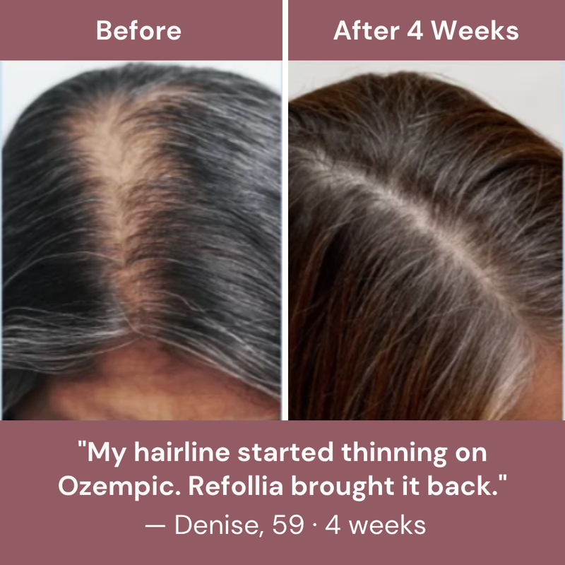 Before and after photo